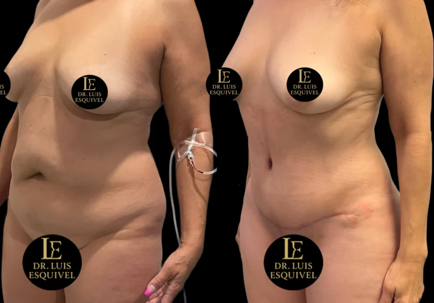Dr Luis Gabriel Esquivel Cirujano Plastico